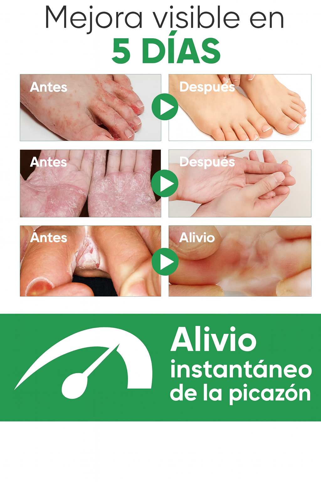 Spray Refrescante para Pies
