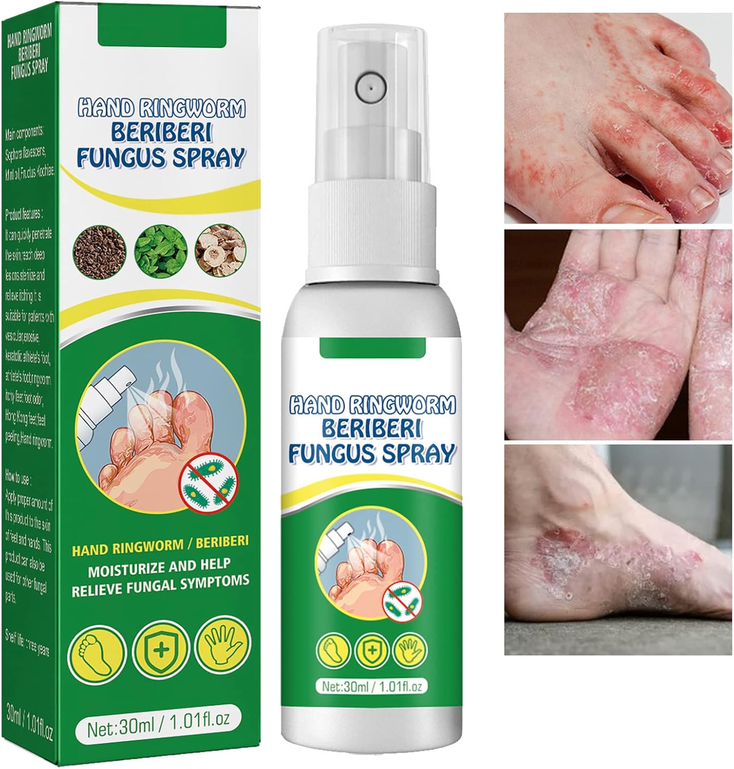 Spray Refrescante para Pies