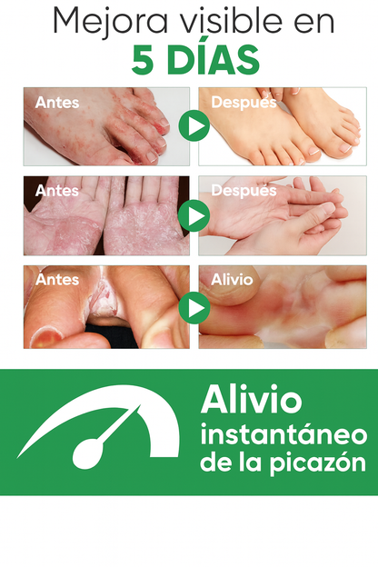 Spray Refrescante para Pies