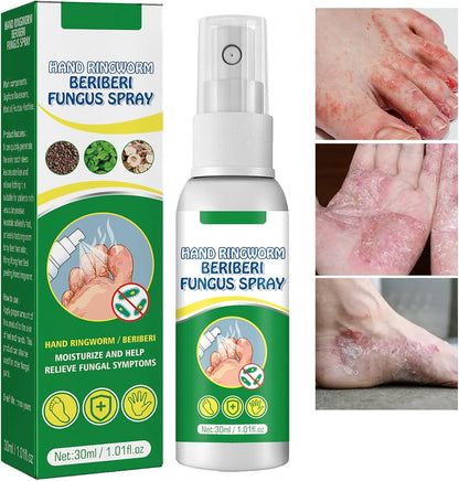 Spray Refrescante para Pies